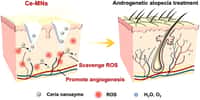 Les nanoparticules de cérium éliminent les molécules responsables du stress oxydatif et stimulent la formation de nouveaux vaisseaux sanguins. © ACS Nano 2021